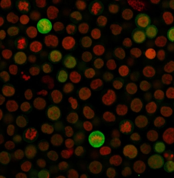 Immunofluorescent staining of fixed human Jurkat cells with anti-Bax antibody (clone SPM336, green) and NucSpot nuclear stain (red).