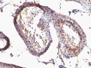 IHC: Formalin-fixed, paraffin-embedded human testicular carcinoma stained with anti-TGF alpha antibody (clone SPM542).