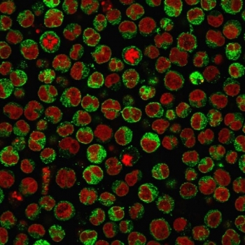 Immunofluorescent staining of PFA-fixed human Raji cells with CD79 antibody (clone SPM550, green) and Reddot nuclear stain (red).