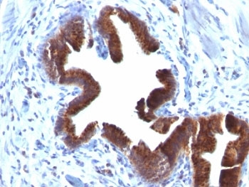 IHC: Formalin-fixed, paraffin-embedded human gallbladder stained with anti-Golgi antibody (SPM581).