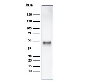 Western blot testing of human HCT116 cell lysate using recombinant Cyclin E1 antibody (clone rCCNE1/4936). Predicted molecular weight ~47 kDa.