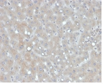 IHC staining of FFPE human liver tissue with Apolipoprotein B antibody (clone APOB/4335). HIER: boil tissue sections in pH 9 10mM Tris with 1mM EDTA for 20 min and allow to cool before testing.