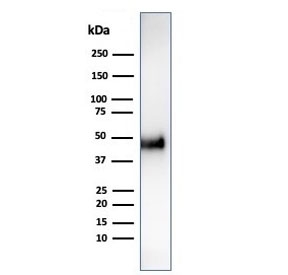 Western blot testing of human HCT-116 cell lysate using recombinant CCNE1 antibody (clone CCNE1/4935R). Predicted molecular weight ~47 kDa.