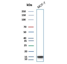 IHC staining of FFPE human bladder tissue with phospho-Histone H3 antibody (clone rPHH3/6824). HIER: boil tissue sections in pH 9 10mM Tris with 1mM EDTA for 20 min and allow to cool before testing.