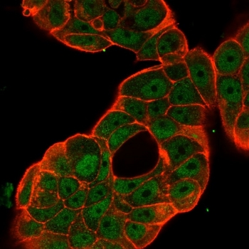Immunofluorescent staining of PFA-fixed human MCF-7 cells using p65 NF-kB antibody (green, clone PCRP-RELA-1E3) and phalloidin (red).