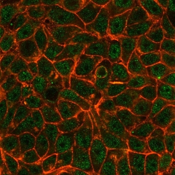 Immunofluorescent staining of PFA-fixed MCF7 cells using TIF1 alpha antibody (green, clone PCRP-TRIM24-1B12) and phalloidin (red).