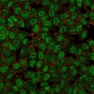 Immunofluorescent staining of PFA-fixed human HeLa cells using ZMYM3 antibody (green, clone PCRP-ZMYM3-2F10) and phalloidin (red).