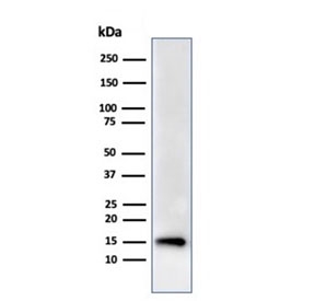 Western blot testing of human HeLa cell lysate using recombinant FABP5 antibody (clone rFABP5/6354). Predicted molecular weight ~15 kDa.