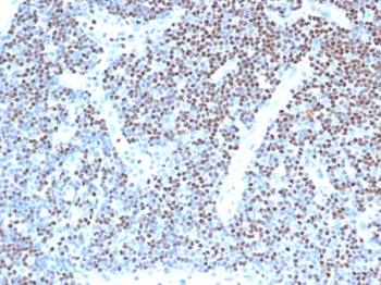 IHC staining of FFPE human lymph node with LEF1 antibody (clone LEF1/341R) at 2ug/ml in PBS for 30min RT. Strong nuclear staining of non-germinal center observed. HIER: boil tissue sections in pH 9 10mM Tris with 1mM EDTA for 20 min and allow to cool before testing.