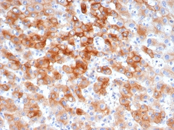 IHC staining of FFPE human colon tissue with recombinant Keratin 8 antibody (clone KRT8/6472R). HIER: boil tissue sections in pH 9 10mM Tris with 1mM EDTA for 20 min and allow to cool before testing.