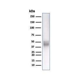 Western blot testing of human Jurkat cell lysate with CD5 antibody. Observed molecular weight: 55~67 kDa depending on glycosylation level.