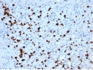 IHC staining of FFPE human bone marrow with Myeloperoxidase antibody (clone MPO/7118). HIER: boil tissue sections in pH 9 10mM Tris with 1mM EDTA for 20 min and allow to cool before testing.