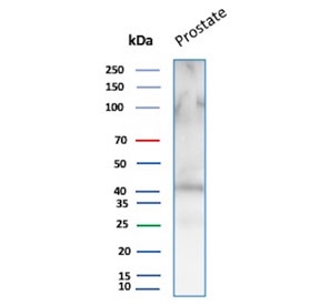Western blot testing of human prostate tissue lysate with recombinant CD47 antibody (clone rCD47/6589). Expected molecular weight: 35~60 kDa depending on glycosylation level.