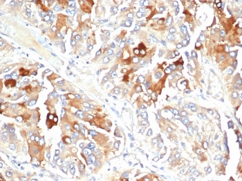 IHC staining of FFPE human adrenal gland tissue with APO-J antibody (clone CLU/4723). HIER: boil tissue sections in pH 9 10mM Tris with 1mM EDTA for 20 min and allow to cool before testing.