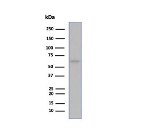 Western blot testing of human MCF-7 cell lysate using recombinant ESR1 antibody (clone ESR1/6983R).