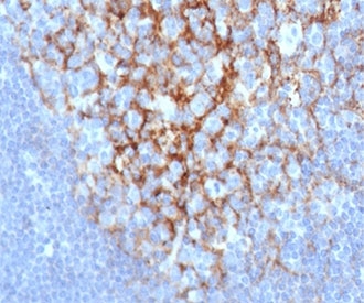 IHC staining of FFPE human lymph node with CD23 antibody (clone FCER2/6892) at 2ug/ml in PBS for 30min RT. HIER: boil tissue sections in pH 9 10mM Tris with 1mM EDTA for 20 min and allow to cool before testing.