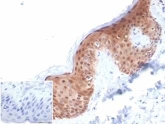 IHC staining of FFPE human skin with SERPINB5 antibody (clone SERPINB5/4972). Negative control inset: PBS used instead of primary antibody to control for secondary Ab binding. HIER: boil tissue sections in pH 9 10mM Tris with 1mM EDTA for 20 min and allow to cool before testing.