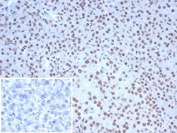 IHC staining of FFPE human pancreatic tissue with Nucleolin antibody (clone NCL/7338). HIER: boil tissue sections in pH 9 10mM Tris with 1mM EDTA for 20 min and allow to cool before testing.
