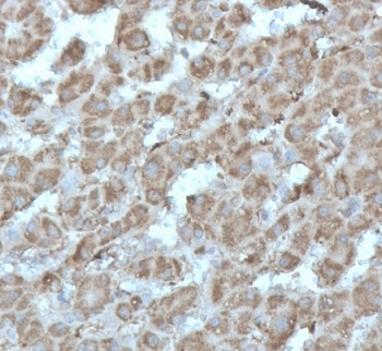 IHC staining of FFPE human liver tissue with recombinant DNA topoisomerase I antibody (clone rTOP1MT/488). HIER: boil tissue sections in pH 9 10mM Tris with 1mM EDTA for 20 min and allow to cool before testing.