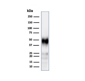 Western blot testing of human Jurkat cell lysate using recombinant CD2 antibody (clone LFA2/3417R). Expected molecular weight ~47 kDa.