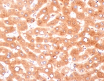 IHC staining of FFPE human liver tissue with Alpha-1-Antichymotrypsin antibody (clone SERPINA3/4187). HIER: boil tissue sections in pH 9 10mM Tris with 1mM EDTA for 20 min and allow to cool before testing.