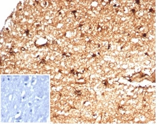 IHC staining of FFPE human brain tissue with recombinant Aldehyde Dehydrogenase 1A1  antibody (clone ALDH1A1/7011R). Negative control inset: PBS instead of primary antibody to control for secondary binding. HIER: boil tissue sections in pH 9 10mM Tris with 1mM EDTA for 20 min and allow to cool before testing.