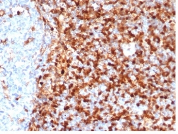 IHC staining of FFPE human tonsil tissue with ANXA1 antibody (clone rANXA1/6451). HIER: boil tissue sections in pH 9 10mM Tris with 1mM EDTA for 20 min and allow to cool before testing.