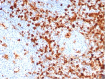 IHC staining of FFPE human tonsil tissue with Annexin A1 antibody (clone ANXA1/6452R). HIER: boil tissue sections in pH 9 10mM Tris with 1mM EDTA for 20 min and allow to cool before testing.