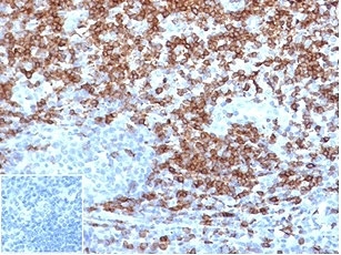 IHC staining of FFPE human tonsil tissue with recombinant CD5 antibody (clone C5/4516R) at 2ug/ml in PBS for 30min RT. Strong surface staining observed. Negative control inset: PBS used instead of primary antibody to control for secondary Ab binding. HIER: boil tissue sections in pH 9 10mM Tris with 1mM EDTA for 20 min and allow to cool before testing.