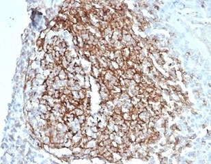 IHC staining of FFPE human kidney tissue with recombinant CD35 antibody (clone CD35/7016R) at 2ug/ml. HIER: boil tissue sections in pH 9 10mM Tris with 1mM EDTA for 20 min and allow to cool before testing.