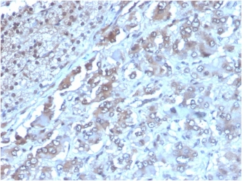 IHC staining of FFPE human adrenal gland with IL-2 antibody (clone IL2/3949). HIER: boil tissue sections in pH 9 10mM Tris with 1mM EDTA for 20 min and allow to cool before testing.