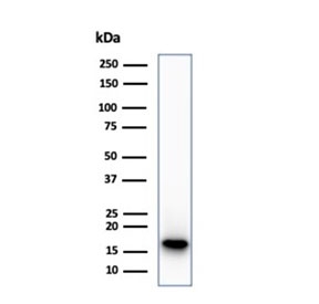 Western blot testing of human HepG2 cell lysate using recombinant CDKN2A antibody (clone CDKN2A/7081R). Predicted molecular weight ~16 kDa.
