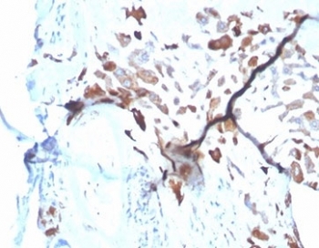 IHC staining of FFPE human placental tissue with SPARC antibody (clone OSTN/3933). HIER: boil tissue sections in pH 9 10mM Tris with 1mM EDTA for 20 min and allow to cool before testing.