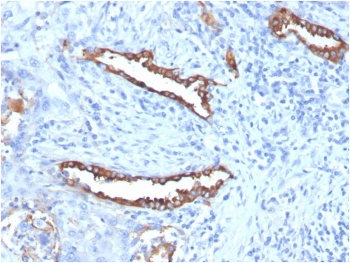 IHC staining of FFPE human lung tissue with recombinant Surfactant Protein D antibody (clone SFTPD/7085R). HIER: boil tissue sections in pH 9 10mM Tris with 1mM EDTA for 20 min and allow to cool before testing.