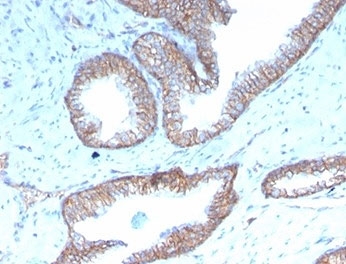 IHC staining of FFPE human prostate tissue with recombinant SHBG antibody (clone rSHBG/245). HIER: boil tissue sections in pH 9 10mM Tris with 1mM EDTA for 20 min and allow to cool before testing.