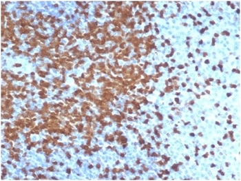 IHC staining of FFPE human tonsil tissue with recombinant ZAP70 antibody (clone ZAP70/6492R). HIER: boil tissue sections in pH 9 10mM Tris with 1mM EDTA for 20 min and allow to cool before testing.