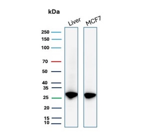 IHC staining of FFPE human prostate tissue with recombinant HSP27 antibody (clone HSPB1/7038R). HIER: boil tissue sections in pH 9 10mM Tris with 1mM EDTA for 20 min and allow to cool before testing.