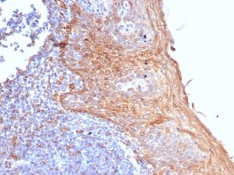 IHC staining of FFPE human tonsil tissue with STING1 antibody (clone STING1/7431). HIER: boil tissue sections in pH 9 10mM Tris with 1mM EDTA for 20 min and allow to cool before testing.