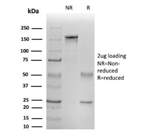 SDS-PAGE analysis of purified, BSA-free IL1B antibody (clone IL1B/465) as confirmation of integrity and purity.