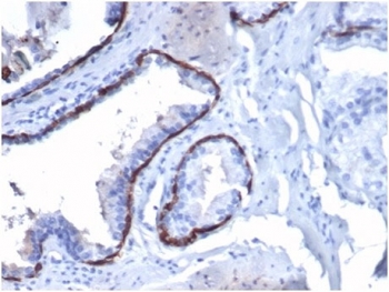 IHC staining of FFPE human prostate tissue with CK14 antibody (clone KRT14/4130) at 2ug/ml. HIER: boil tissue sections in pH 9 10mM Tris with 1mM EDTA for 20 min and allow to cool before testing.
