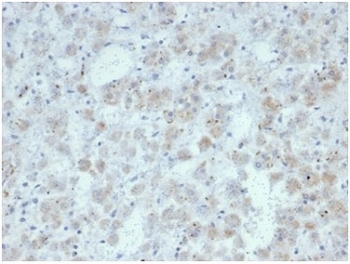 IHC staining of FFPE human adrenal gland tissue with recombinant IL15 antibody (clone IL15/7048R). HIER: boil tissue sections in pH 9 10mM Tris with 1mM EDTA for 20 min and allow to cool before testing.