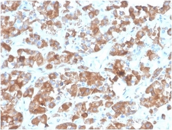 IHC staining of FFPE human pituitary tissue with LH beta antibody (clone rLHb/1613). HIER: boil tissue sections in pH 9 10mM Tris with 1mM EDTA for 20 min and allow to cool before testing.
