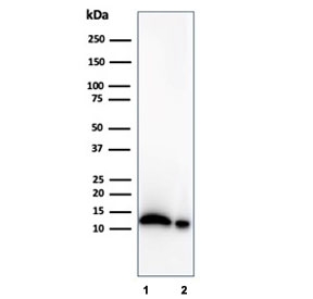 Western blot testing of human 1) LNCaP and 2) PC3 cell lysates using Macrophage Migration Inhibitory Factor antibody (clone MIF/4336). Predicted molecular weight ~13 kDa.