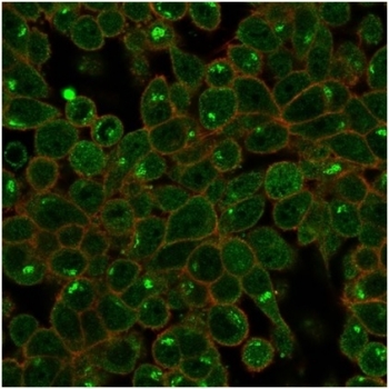 Immunofluorescent staining of PFA-fixed human HeLa cells using ZSCAN2 antibody (green, clone PCRP-ZSCAN2-1F8) and phalloidin (red).