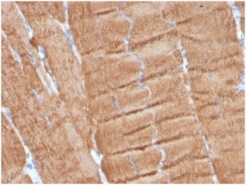 IHC staining of FFPE human skeletal muscle with Actin alpha 1 antibody (clone ACTA1/360). HIER: boil tissue sections in pH 9 10mM Tris with 1mM EDTA for 20 min and allow to cool before testing.