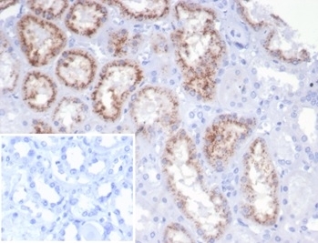 IHC staining of FFPE human kidney tissue with recombinant RBP4 antibody (clone rRBP4/7372). Negative control inset: PBS instead of primary antibody to control for secondary binding. HIER: boil tissue sections in pH 9 10mM Tris with 1mM EDTA for 20 min and allow to cool before testing.