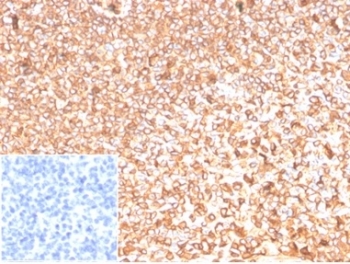 IHC staining of FFPE human tonsil tissue with Actin Beta antibody (clone ACTB/1109). Negative control inset: PBS used instead of primary antibody to control for secondary Ab binding. HIER: boil tissue sections in pH 9 10mM Tris with 1mM EDTA for 20 min and allow to cool before testing.
