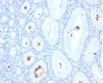IHC staining of FFPE human H. pylori-infected stomach tissue with Helicobacter pylori antibody (clone HPYL/7172). HIER: boil tissue sections in pH 9 10mM Tris with 1mM EDTA for 20 min and allow to cool before testing.