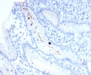 IHC staining of FFPE human H. pylori-infected stomach with Helicobacter pylori (clone HPYL/7225) antibody (clone HPYL/7225). HIER: boil tissue sections in pH 9 10mM Tris with 1mM EDTA for 20 min and allow to cool before testing.
