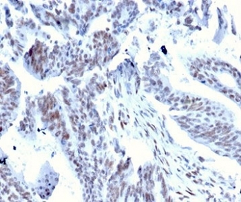 IHC staining of FFPE human colon tissue with Serum Response Factor antibody (clone PCRP-SF7-1F1) at 2ug/ml in PBS for 30min RT. HIER: boil tissue sections in pH 9 10mM Tris with 1mM EDTA for 20 min and allow to cool before testing.